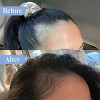 Anti-Hair Loss Shampoo & Conditioner + Hair & Scalp Leave-In Treatment (SAVE 30%)