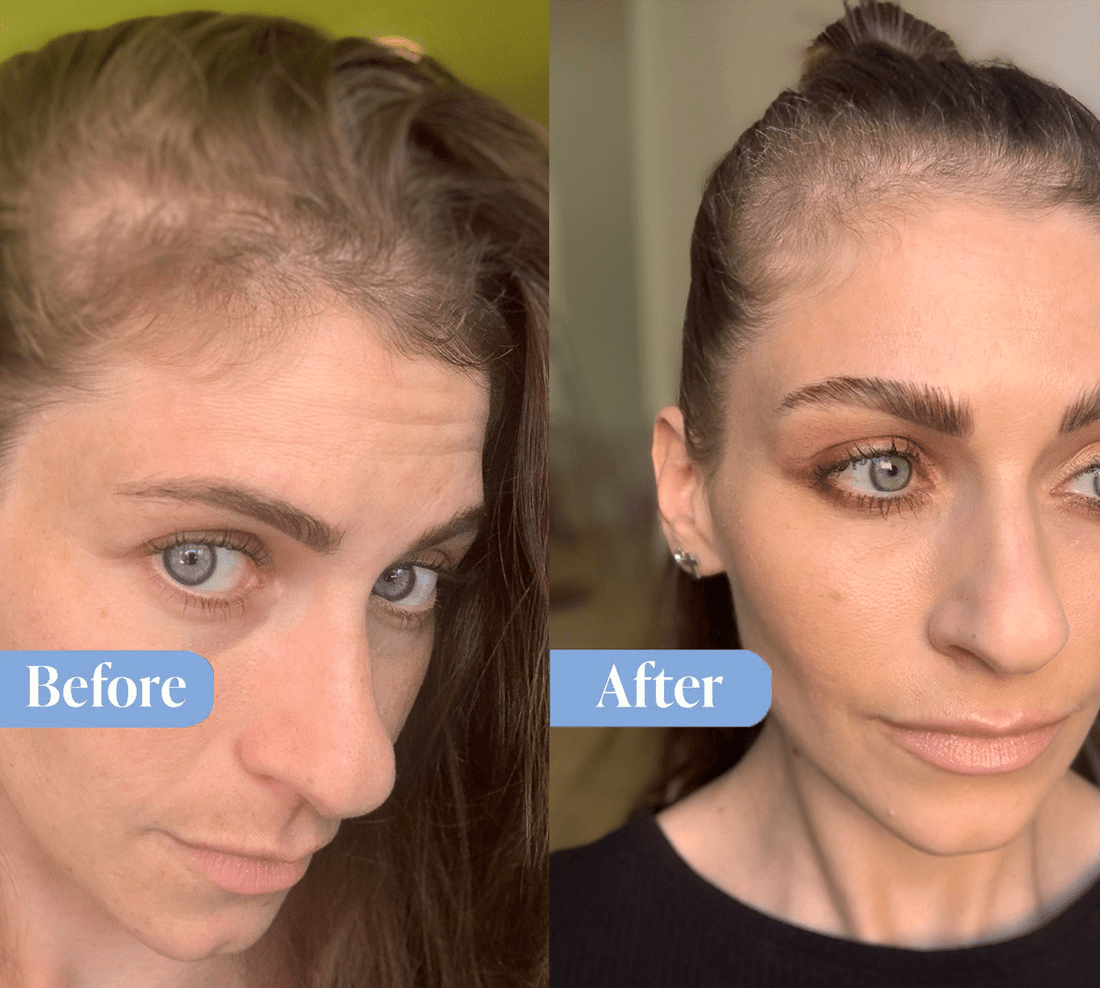 Anti-Hair Loss Shampoo & Conditioner Bundle