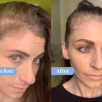 Anti-Hair Loss Shampoo & Conditioner Bundle